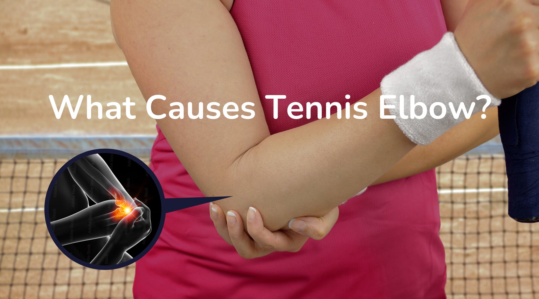 How Tennis Elbow Happens - Causes, Symptoms & Treatments